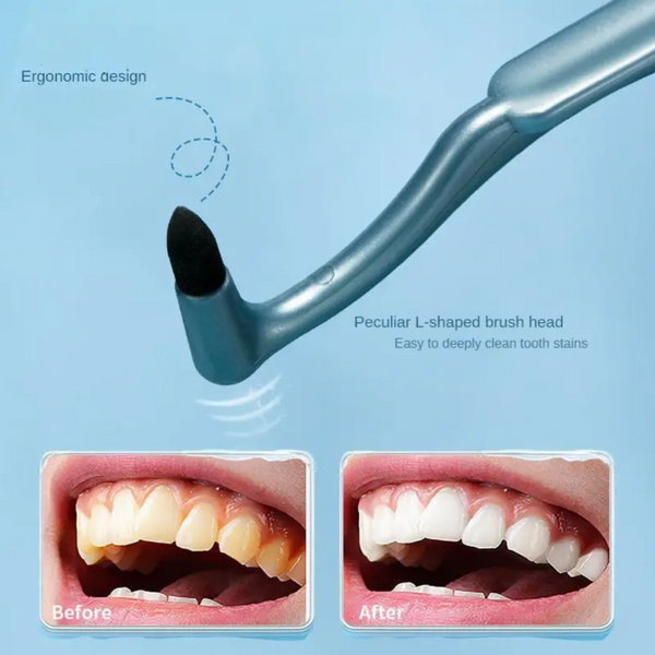 Dental Stain Cleaner Tool – Rubberized Silicon Carbide Tooth Stain Removal Brush